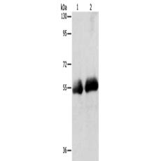 兔抗SLC5A5多克隆抗体 