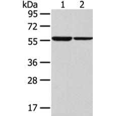  兔抗SLC7A11多克隆抗体 