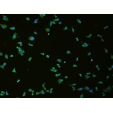 兔抗SLC18A3多克隆抗体