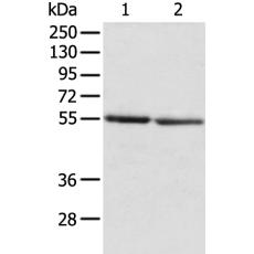 兔抗SLC29A1多克隆抗体