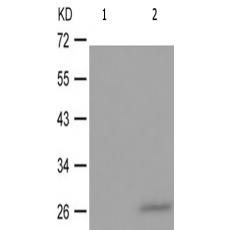 兔抗TNNI3(Phospho-Ser43)多克隆抗体