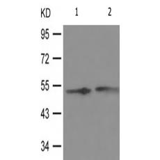 兔抗RPS6KB2(Phospho-Ser423) 多克隆抗体  