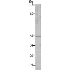 兔抗PSKH1多克隆抗体
