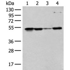  兔抗RRP1多克隆抗体   
