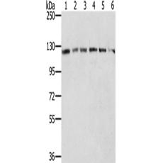 兔抗RNF20多克隆抗体   