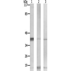 兔抗SERPINB9多克隆抗体 