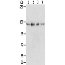 兔抗RBM5多克隆抗体  