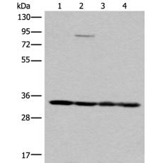兔抗MRPL1多克隆抗体