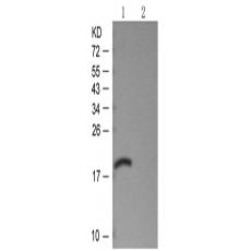 兔抗STMN1(Phospho-Ser38)多克隆抗体