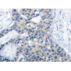 兔抗STMN1(Phospho-Ser38)多克隆抗体