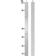 兔抗SF1(Phospho-Ser82) 多克隆抗体  