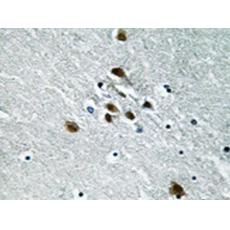 兔抗SF1(Phospho-Ser82) 多克隆抗体  