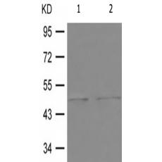 兔抗PTPN1(Phospho-Ser50)多克隆抗体