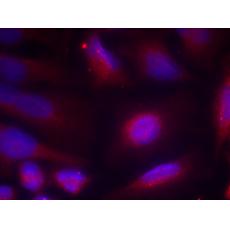兔抗NTRK1 (Phospho-Ser791)多克隆抗体