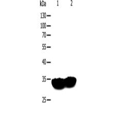 兔抗TPM1多克隆抗体