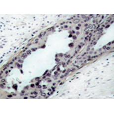 兔抗PTEN (Phospho-Ser380 Thr382 Thr383)多克隆抗体