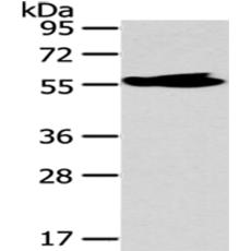 兔抗MPP6多克隆抗体