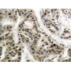 兔抗NFKB1 (Phospho-Ser337)多克隆抗体