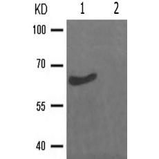 兔抗SMAD2(Phospho-Ser250)多克隆抗体