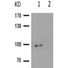 兔抗PGR(Phospho-Ser400)多克隆抗体