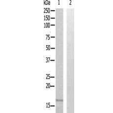 兔抗RPS23多克隆抗体  