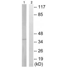 兔抗NEUROD1(Phospho-Ser274)多克隆抗体