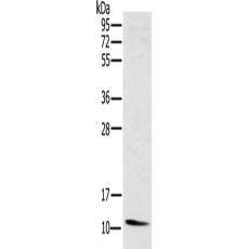 兔抗NDUFA3多克隆抗体