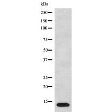 兔抗MT-ND4L多克隆抗体