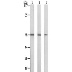 兔抗SIRPB1多克隆抗体 