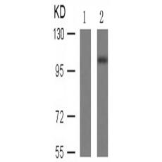 兔抗RB1 (Phospho-Ser807)多克隆抗体   