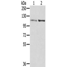 兔抗SENP7多克隆抗体  