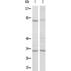  兔抗RPS4X多克隆抗体   