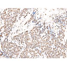兔抗H2BC11多克隆抗体 