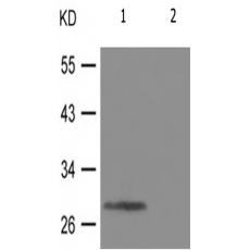 兔抗SNAI1(Phospho-Ser246)多克隆抗体