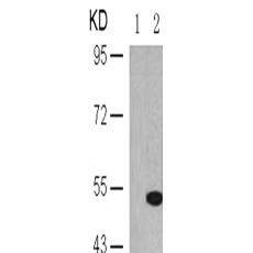 兔抗TP53 (Phospho-Ser33)多克隆抗体