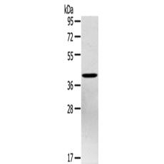  兔抗PTX3多克隆抗体 