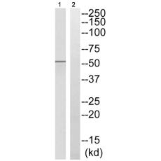 兔抗SMAD2(Phospho-Ser465)多克隆抗体