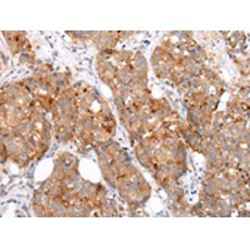 兔抗MUC1(CT)多克隆抗体 
