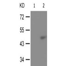兔抗TP53(Phospho-Ser366)多克隆抗体