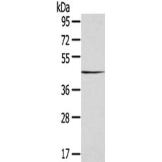 兔抗SEPTIN2多克隆抗体  