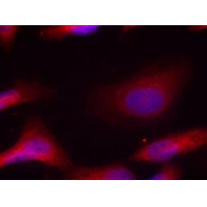 兔抗SRC (Phospho-Tyr529)多克隆抗体