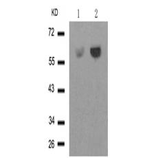 兔抗SRC (Phospho-Tyr529)多克隆抗体