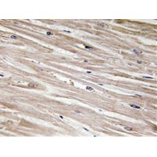 兔抗PEA15(Phospho-Ser104)多克隆抗体