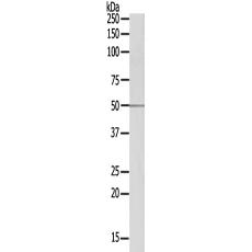 兔抗SEPT14 多克隆抗体 