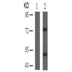 兔抗MAPT (Phospho-Ser214)多克隆抗体