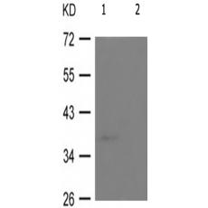 兔抗PRKAB1(Phospho-Ser181)多克隆抗体