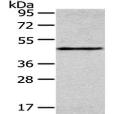 兔抗SMYD2多克隆抗体
