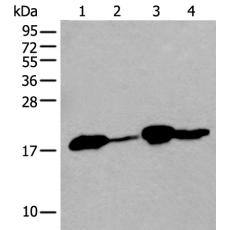 兔抗TMEM254多克隆抗体