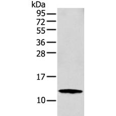 兔抗S100A16多克隆抗体    