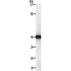 兔抗PPM1L多克隆抗体